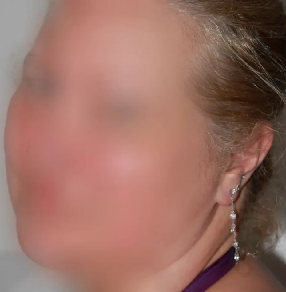 Gunilla, 28